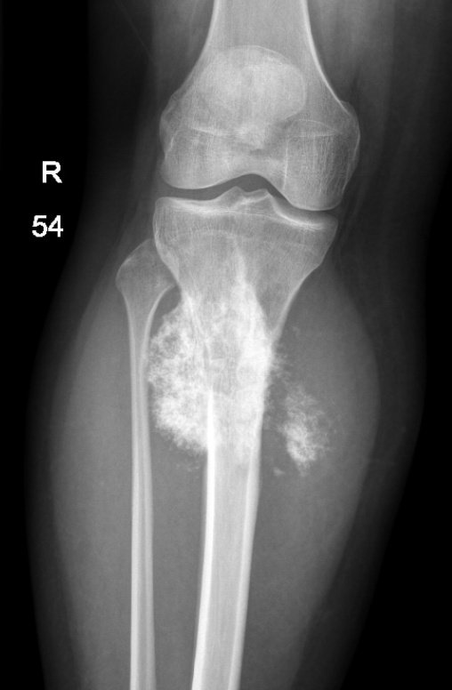 IhabFathiSulima's tweet photo. What is the Sunny  diagnosis ⁉️ https://t.co/J219CWPu6y