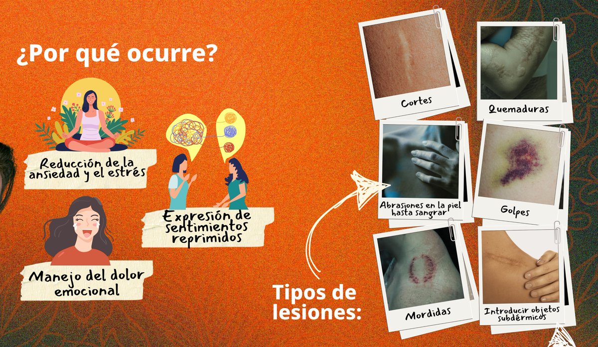 ISSSTE_mx's tweet image. 👂🏻Cada marca es un grito de dolor que necesita ser escuchado. 🧏🏻

Permite que profesionales y seres queridos te ayuden. 🫂

🚨 Si estás en crisis, por favor, contacta a un profesional de la salud. Puedes comunicarte a la #LíneaDeLaVida 📞: 01 800 911 2000, o bien, a través de…