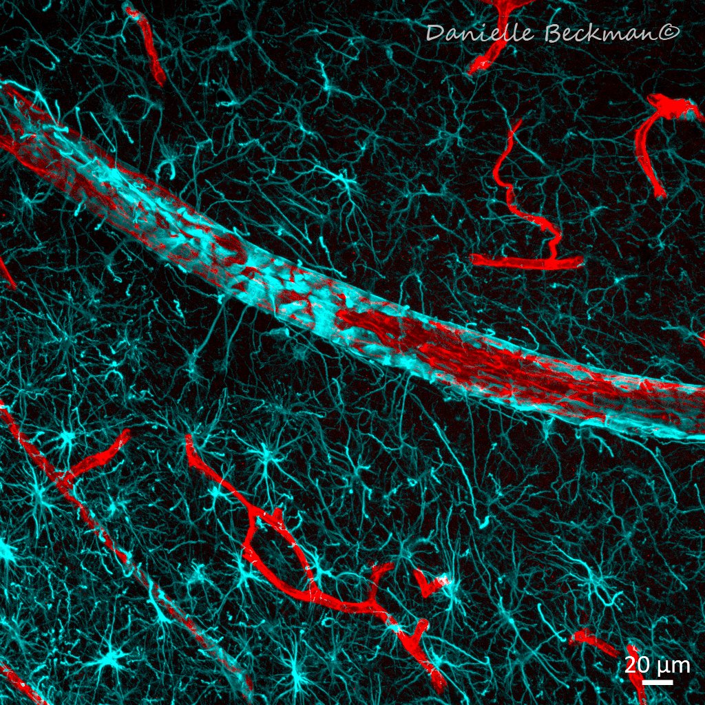 Danielle Beckman tweet media