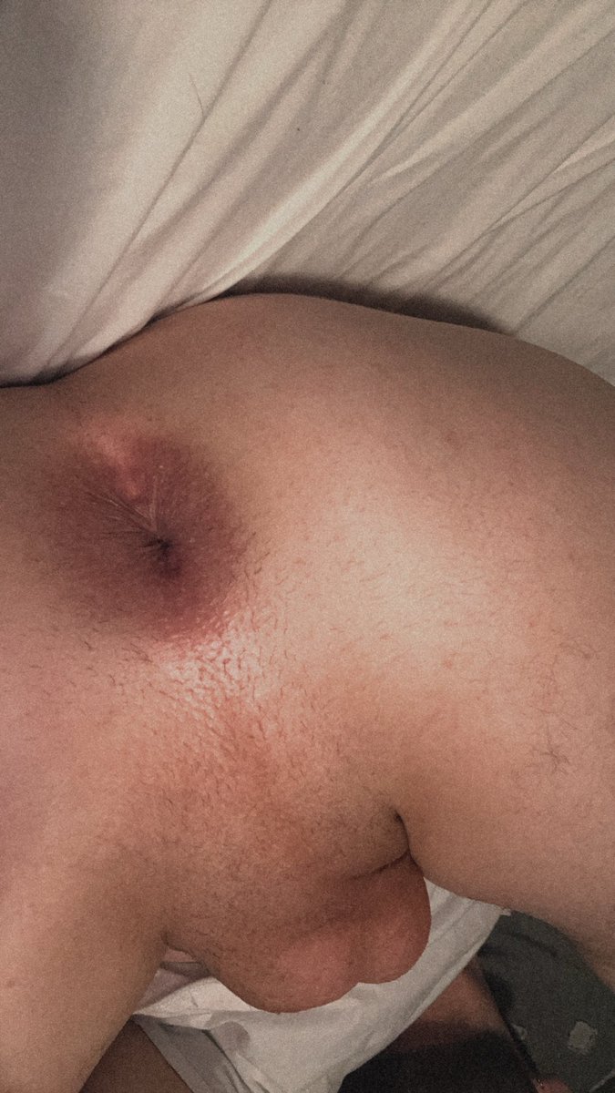 Sorry bro. I had to let it air out😮‍💨