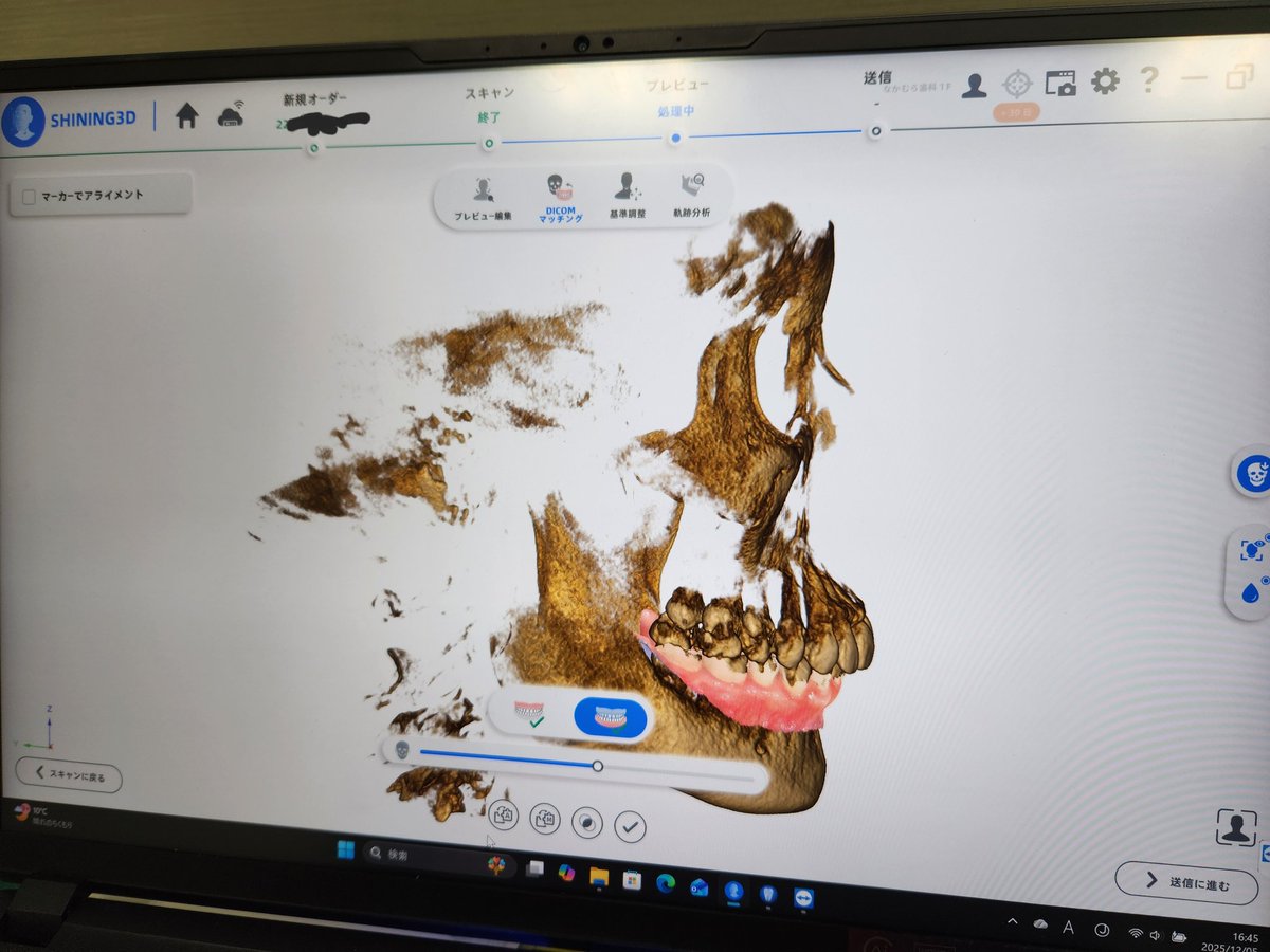午後は院内セミナーだったけど、私は同僚と2人でフェイススキャナーのお勉強。
まともに説明も受けず(中国人の日本語でものすごい早口でよく分からなかった)、とりあえずやってみたけど撃沈🥹
臨床で顎運動描記までスムーズに撮るには特訓が必要だぁ