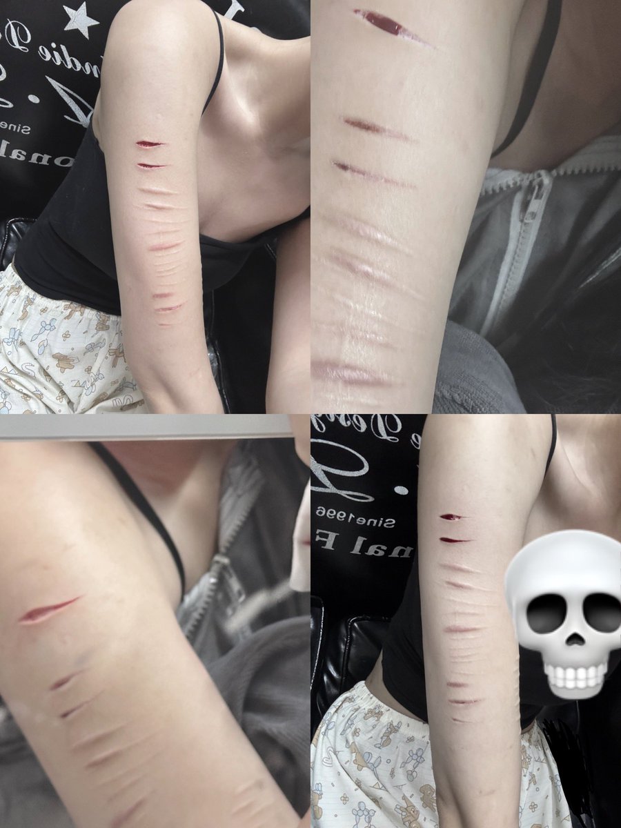 l919_99's tweet photo. #自残 #自傷行為 #自伤 #リスカ  #アムカ #scars https://t.co/fdDJ9Cch9I
