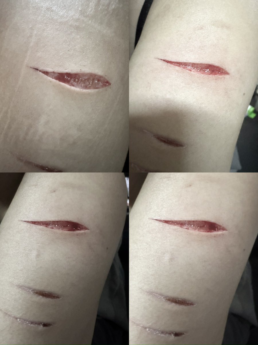 l919_99's tweet photo. #自残 #自傷行為 #自伤 #リスカ  #アムカ #scars https://t.co/fdDJ9Cch9I