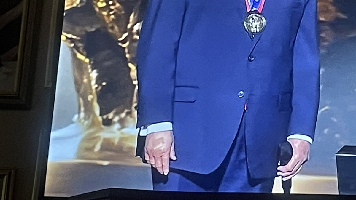 beachaholic823's tweet image. Fifa made up Peace Prize for CHUMP🤣
You Can’t Make This BS Up🤣🤣🤣
Look at that swelling on his hand👀
#UNFIT 
#NoKings 
#FIFA 
#fifaworldcup