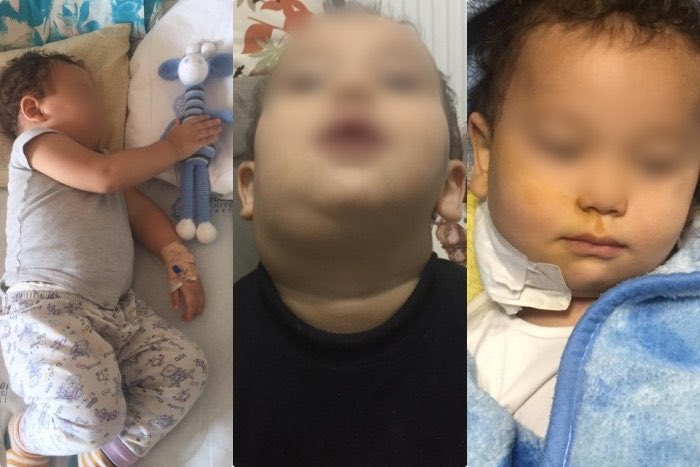 Anne babasının tutuklanmasıyla onlardan ayrı kalan ve verem tedavisi gören 4 yaşındaki Selman, hastane odalarında tek başına kaldı. Yaraları defalarca açılırken onun en büyük ihtiyacı Anne şefkatiydi. Hasta bir çocuğa bu kadar vicdansızlık yapılır mı?

SelmanHasta AnnesiTutuklu