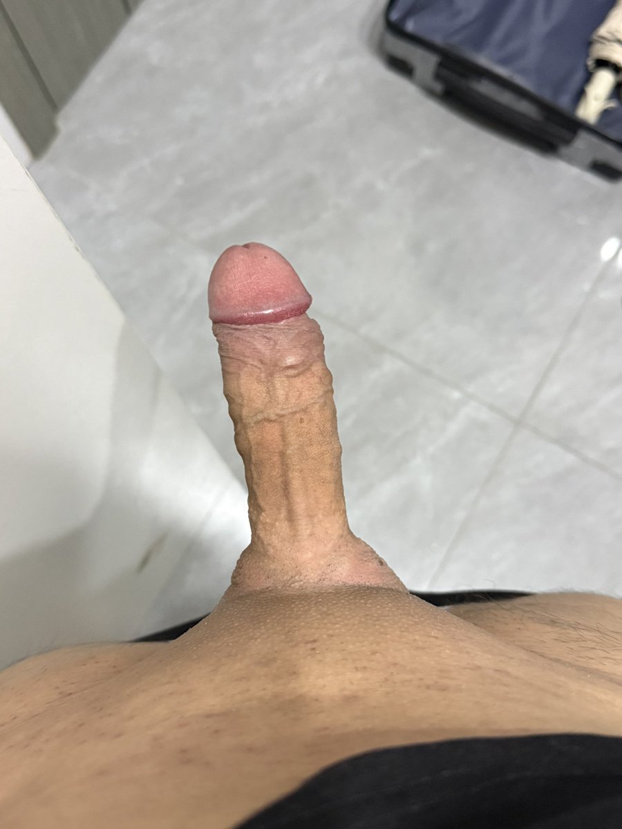 可恶的毛囊炎🍌