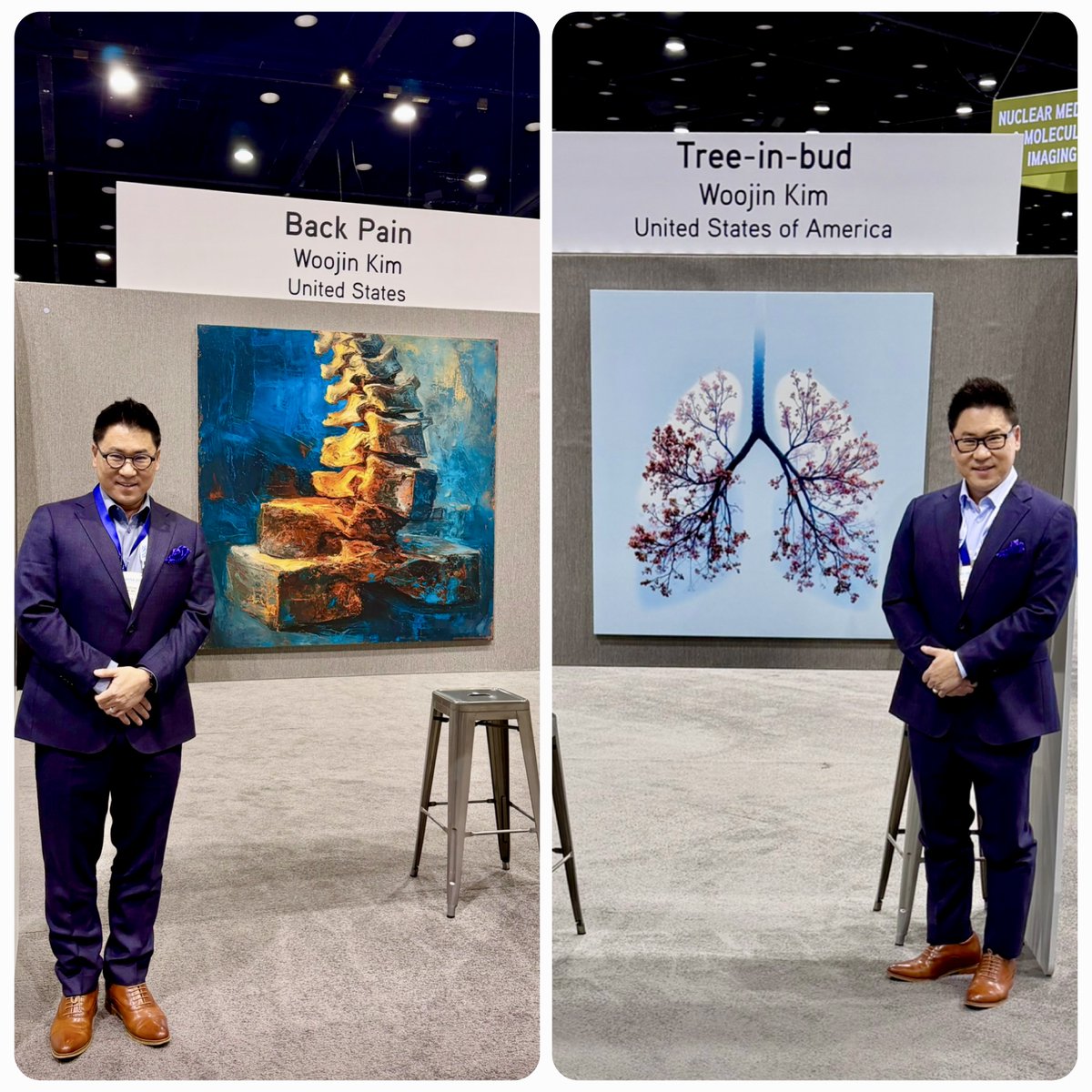 Grateful to see my AI art pieces, "Back Pain" and "Tree‑in‑bud", exhibited at RSNA 2025.

🙏 Thank you for all the kind messages during the meeting.

👏🏼 Congratulations to others whose AI art is also displayed.

#RSNA25 #TheArtofImaging #RadiologyArt #AIart #Radiology #RSNA2025
