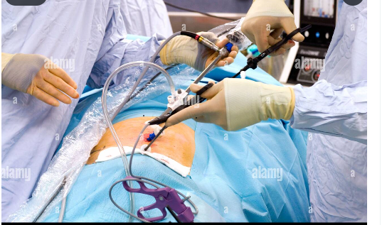 surgerygenesis's tweet photo. Hernia surgery is a surgical procedure that repairs a protruding organ or tissue through a weakened muscle wall, restoring normal anatomy, relieving symptoms, and preventing serious complications such as strangulation.
#HerniaSurgery #MedicalProcedure #GeneralSurgery #Healthcare https://t.co/A76igyiQwV