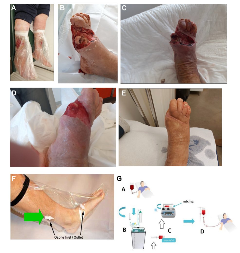 JVS - Venous and Lymphatic Disorders tweet media