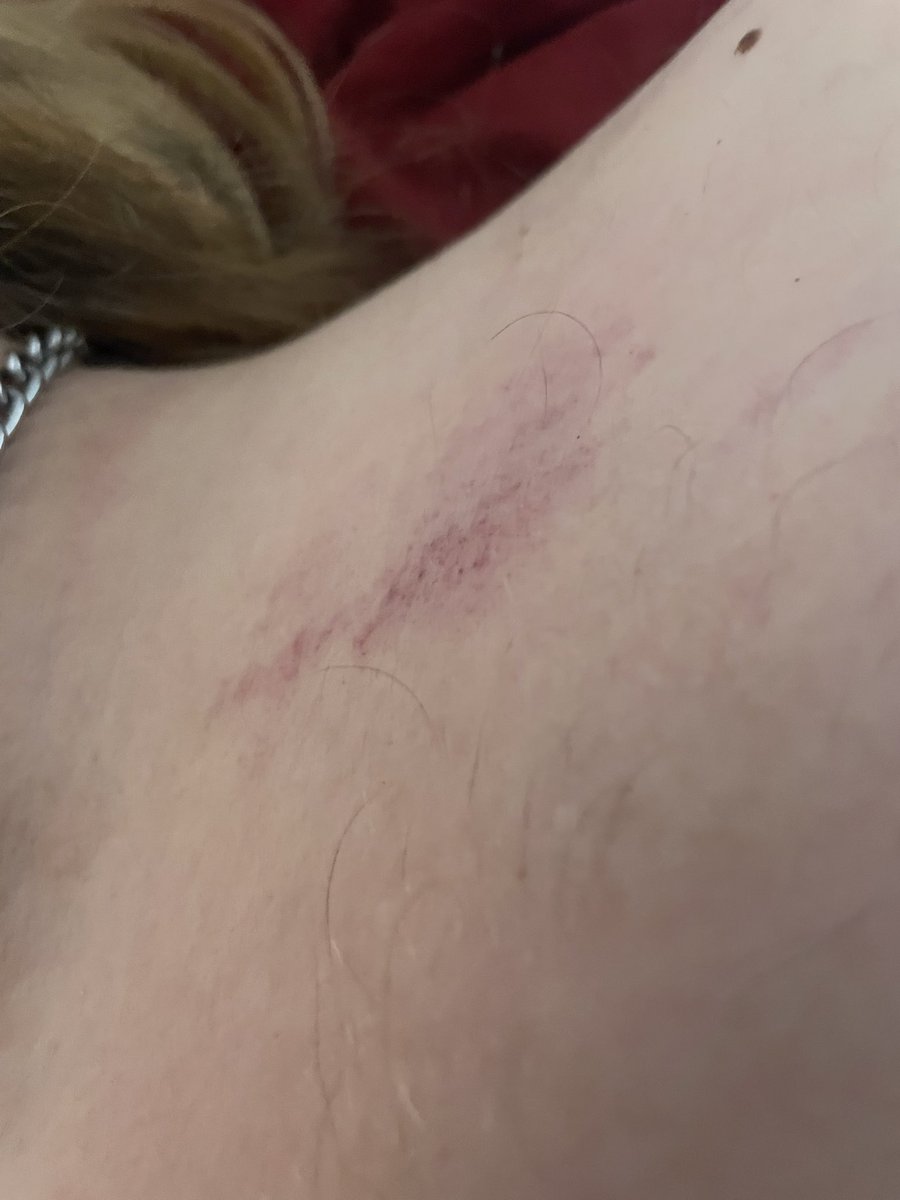 Asylum_moon's tweet photo. This is what pretty girls get when they behave~ @SacrificialOwl was a very good pet. https://t.co/8oJtwZ3DoU
