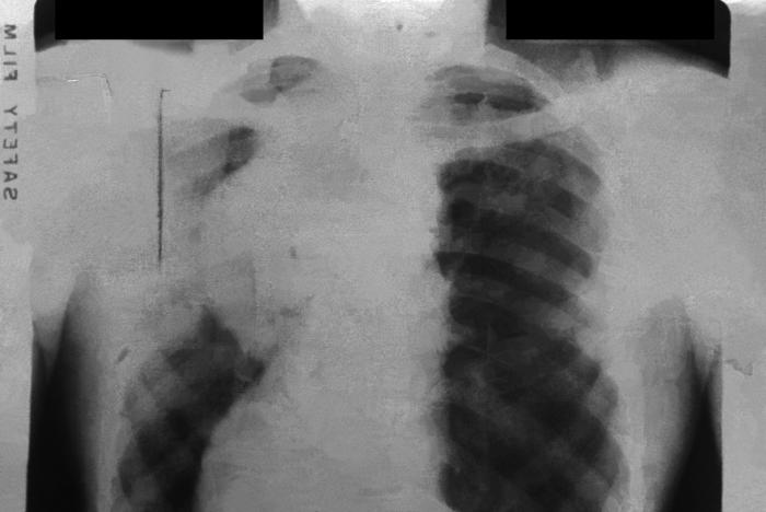 Francis Deng, MD tweet media