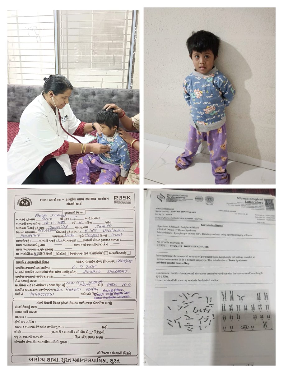 #RastriyaBalSwasthyaKaryakrm 
Home visit of a 3 years old child having Down' s syndrome. Counselling of parents done &amp; Sandarbh card given by RBSK TEAM NO SRC 0945 NEW DINDOLI,SMC <a href="/GujaratSHRBSK/">Gujarat SH (RBSK) Rashtriya Bal Swasthya Karyakram</a> <a href="/GujHealth/">Gujarat Health</a> <a href="/NHMGujarat/">NHM Gujarat</a> <a href="/MoHFW_INDIA/">Ministry of Health</a> #GujHFWDept <a href="/MoHFW_GUJARAT/">Ministry of Health</a> <a href="/MySuratMySMC/">My Surat</a>