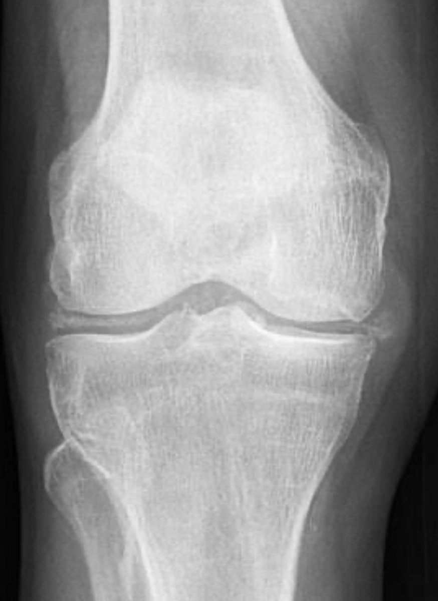 Dr Abhilasha Manwatkar (AIIMS Nagpur) tweet media