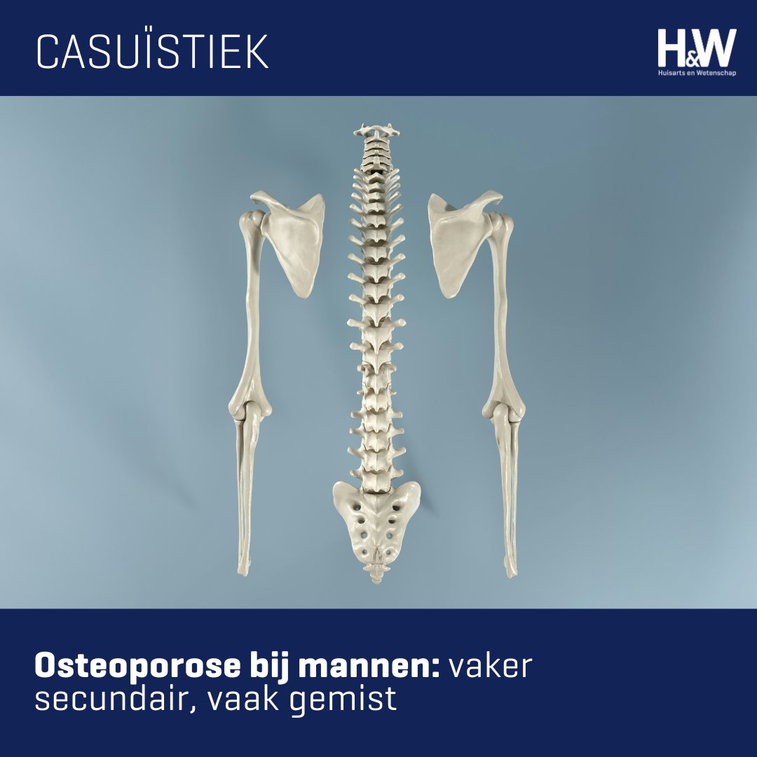 Osteoporose bij mannen wordt vaak gemist. 65% van de mannen met osteoporose heeft een secundaire vorm. Tijdige screening bij mannen > 50 jaar met een fractuur is essentieel om complicaties te voorkomen. 
ow.ly/uOSS50XyUVs

#huisarts #osteoporose #diagnostiek
