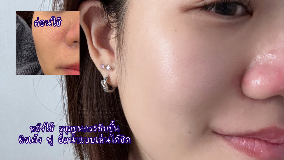 อายุ 20 ปลายแล้ว ไม่สะดวกหน้าหย่อน🥹 ใครรู้สึกเริ่มมีปัญหาผิวแนะนำดูโอ้ครีมม่วง 2 ตัวนี้เลย
☀️ #daycream ไว้ทาตอนเช้า ลงเป็นบำรุงก่อนแต่งหน้าคือผิวฟูขึ้นแบบสุด
🌃 #nightcream ตัวนี้ทาก่อนนอน ตื่นเช้ามาปุ๊บสดชื่น หน้าอิ่ม ชุ่มชื้นมาก
ทั้งสองตัวเนื้อครีมคือดี ซึมไว