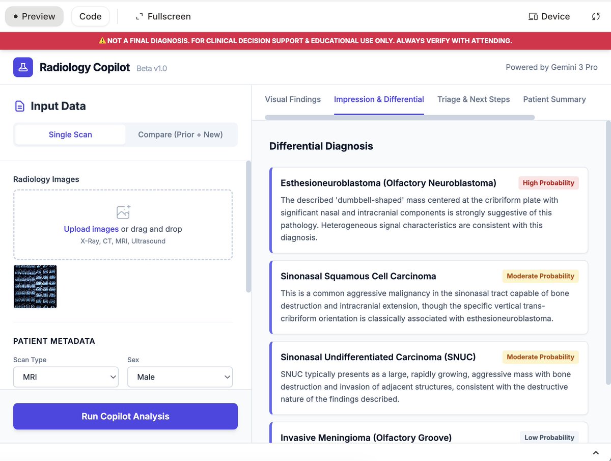 Siddhant_K_code's tweet image. Took Radiology Copilot out of the lab and into a neurology room. Demoed to 7 neurologists, got thoughtful critique + praise.

4 agreed it could ease day-to-day reading and support pre-final verification.

Real-world feedback hits different.  Lots of great suggestions, time to…