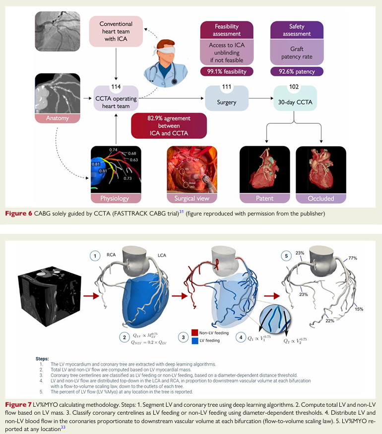 cardioteca's tweet photo. 🆕 Revascularización coronaria en 2040: TC coronario «one-stop shop», IA y era metal-less.

📕 Eur Heart J
🔓 Resumen del artículo en https://t.co/hg0vUsbveK https://t.co/nEZ7i3cgTR