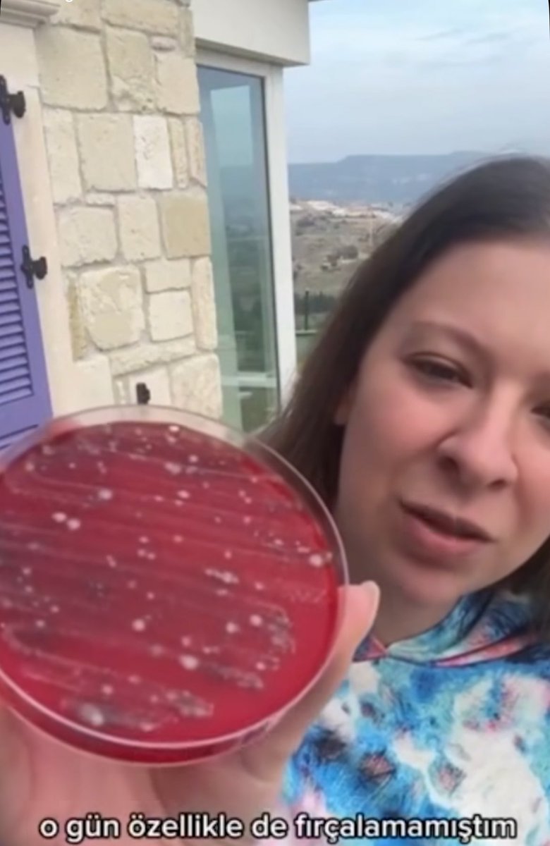 Uzmanı benim gel anlatayım

Kedilerin tükürüğü insanlardan farklı olarak asidik bir pHa sahip bu yüzden zaten bakterilerin yarısını eledik 
Diğer bir kısmını da yine tükürüğün içerisinde bulunan Laktoferrinden eliyoruz (bakterilerin demiri kullanmasını engellediği için