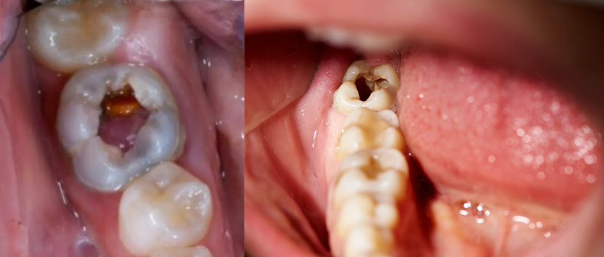 koas gigi 🧚🏻 tweet media