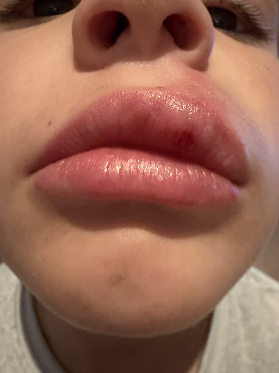 Bueno, creo que la evolución era la lógica…padre médico e hija referente en el mundo de la moda y la belleza. Hemos inaugurado nuestra clínica de medicina estética JJ RUNNING TEAM. Tras varios años perfeccionando la técnica, Su Antiestética Majestad, como médica estética jefa,