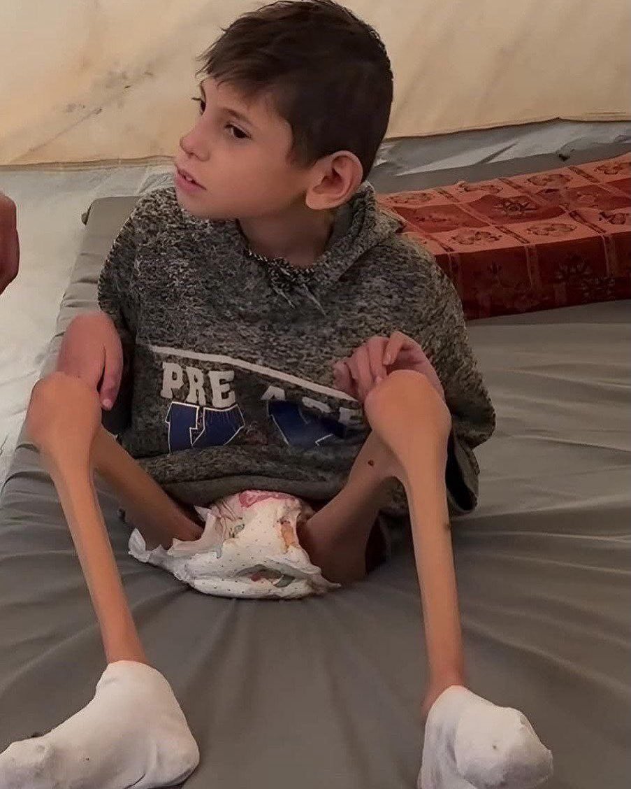 Palestinians are not "facing" starvation.

They are being starved to death by Israel.

Forced starvation is an act of genocide.