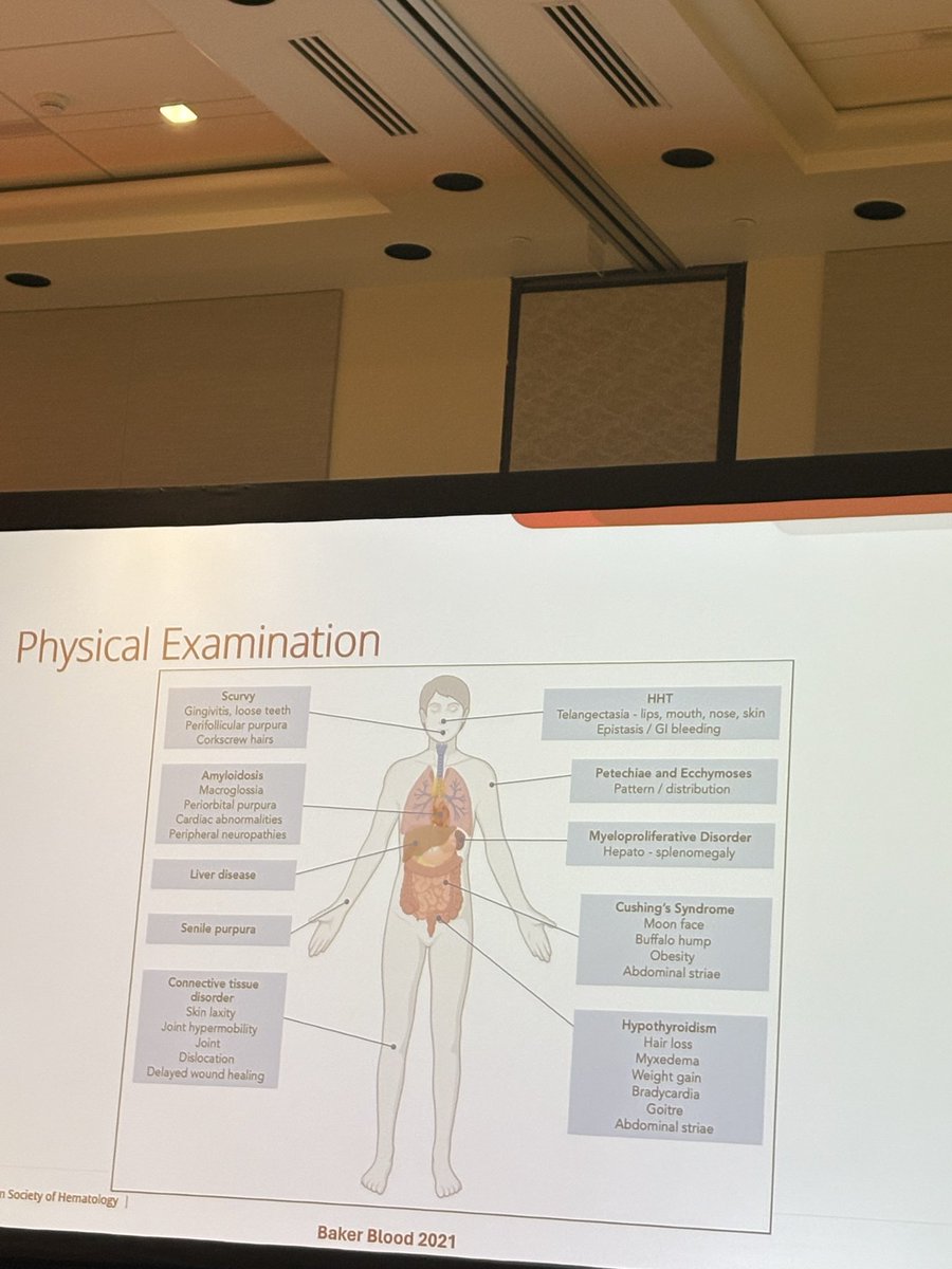 Love this graphic from great BDUC talk for working up abnormal bleeding! 🩸 #ASH25