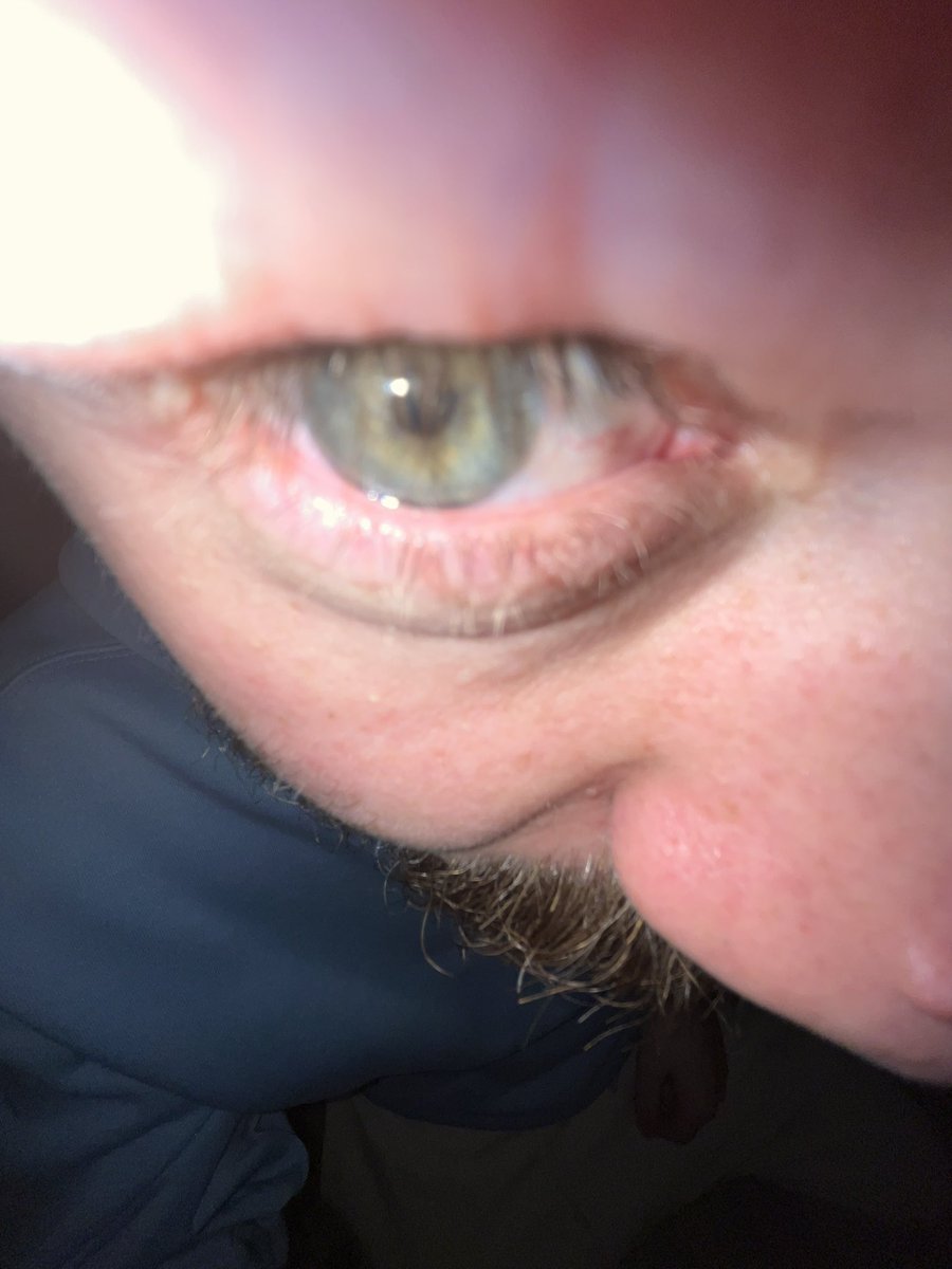 Ви відкриваєте очі, а там стоїть Миколайчик. Ваші дії?