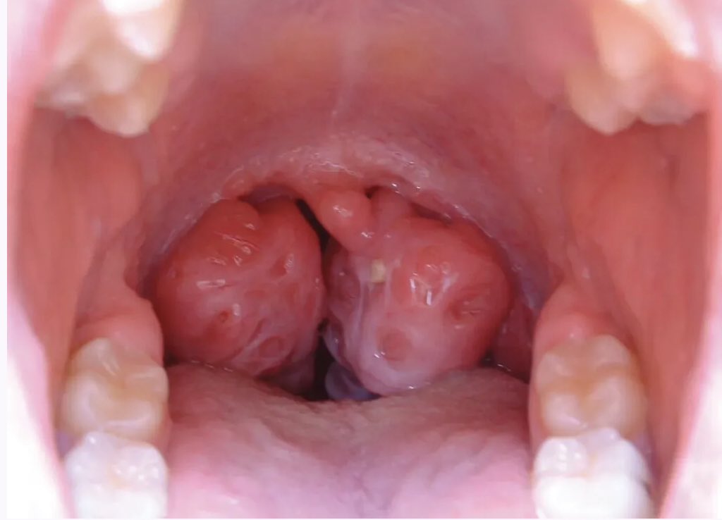 Sage_medics's tweet image. What is the Diagnosis?