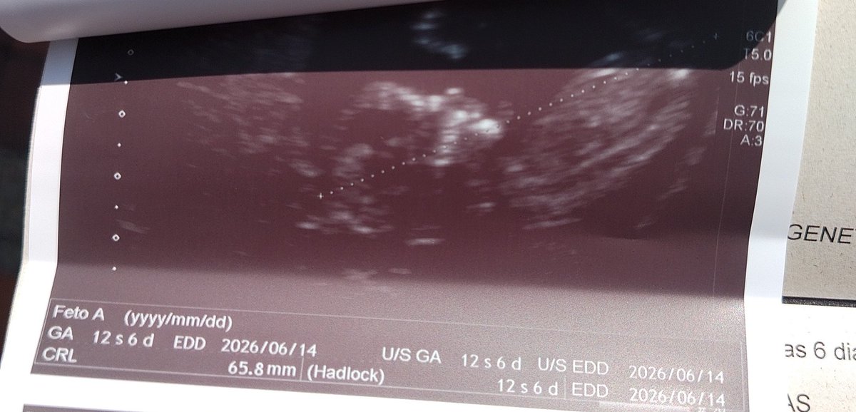 12 semanas y 6 días de vida que tiene mi príncipe o princesa🌹🦈

Te espero con muchas ansias mi rey o reina ❤️... Papi y mami te recibiremos con todo el amor del mundo ❤️❤️❤️❤️