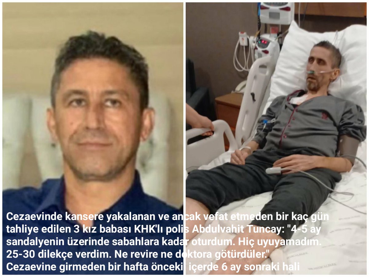 Cezaevinde kanser olan ve vefat eden KHK polis Abdulvahit Tuncay;
"4-5 ay sandalyenin üzerinde sabahlara oturdum. 25-30 dilekçe verdim. Ne revire ne doktora götürdüler"
Rabbimiz rahmet eylesin!
Adaletsizlik Öldürüyor!
AHİRET VAR!
YaşamHakkını Koru
<a href="/AYMBASKANLIGI/">Anayasa Mahkemesi</a> <a href="/TBMMGenelKurulu/">TBMM Genel Kurulu</a>