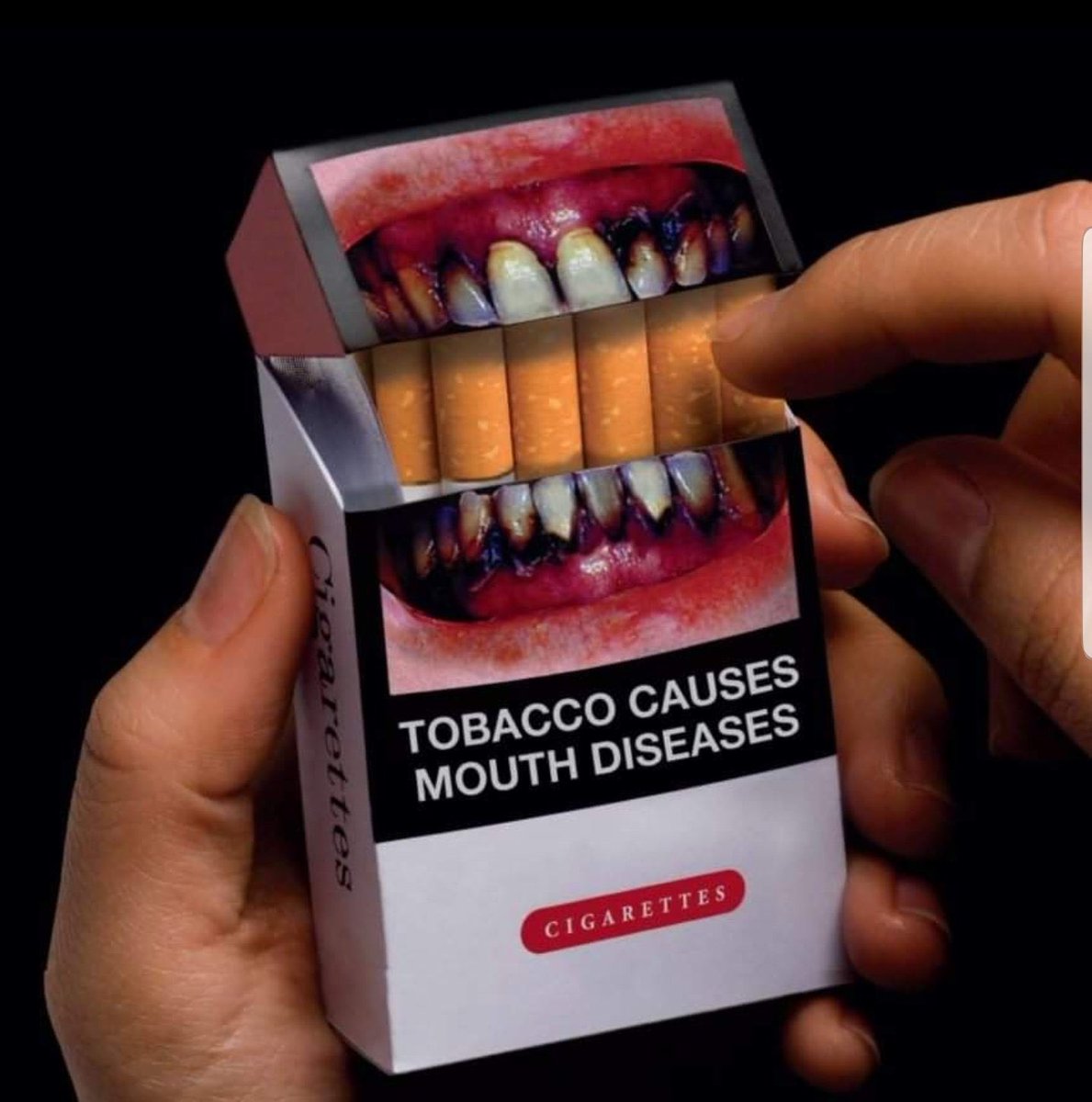 طوال فترة عملي كطبيب
لم أرى أسوأ على صحة الفم من التدخين 🚬 

•رائحة كريهه!!
•مظهره سيء!!
•أمراض مزعجة!!
•أمراض مُميته !!