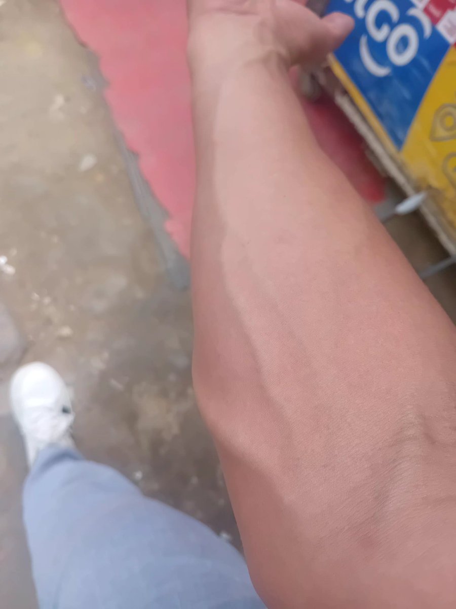 Venosa 🍆💪🏻