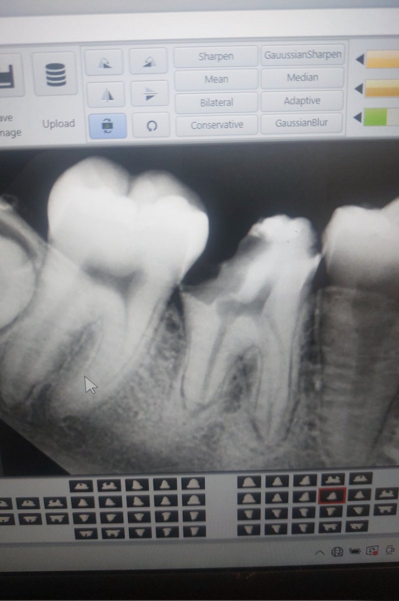 دندانزرشک tweet media