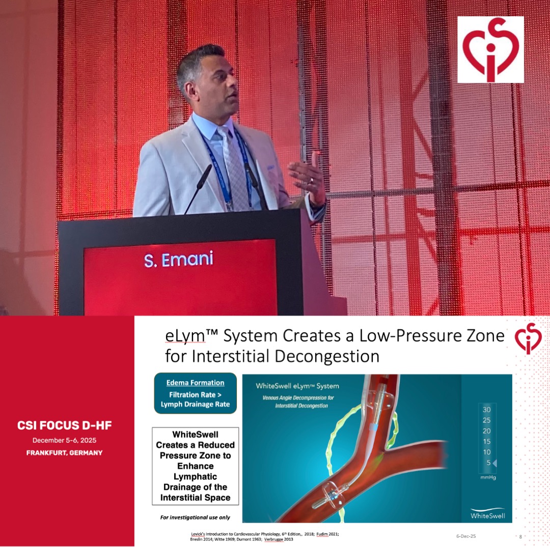Thank you, <a href="/RameshEmani/">Ramesh Emani</a>, for presenting on #lymphatic-powered interstitial decongestion for acute decompensated #heartfailure at #CSIDHF .
Congratulations on an excellent conference by the <a href="/CSIcongress/">CSI Congress</a>  team!