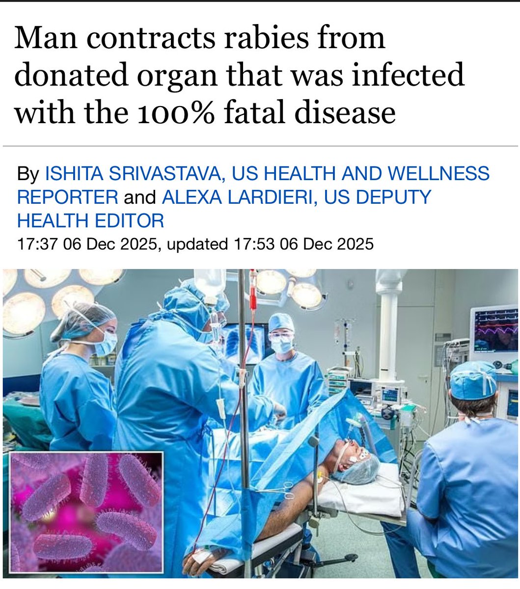 A Michigan man died of rabies after contracting the disease through an organ transplant.

It was revealed that the donor had been scratched by a skunk that left him brain dead.  Three other organ recipients had to have corneal grafts removed after the rabies detection by the CDC.