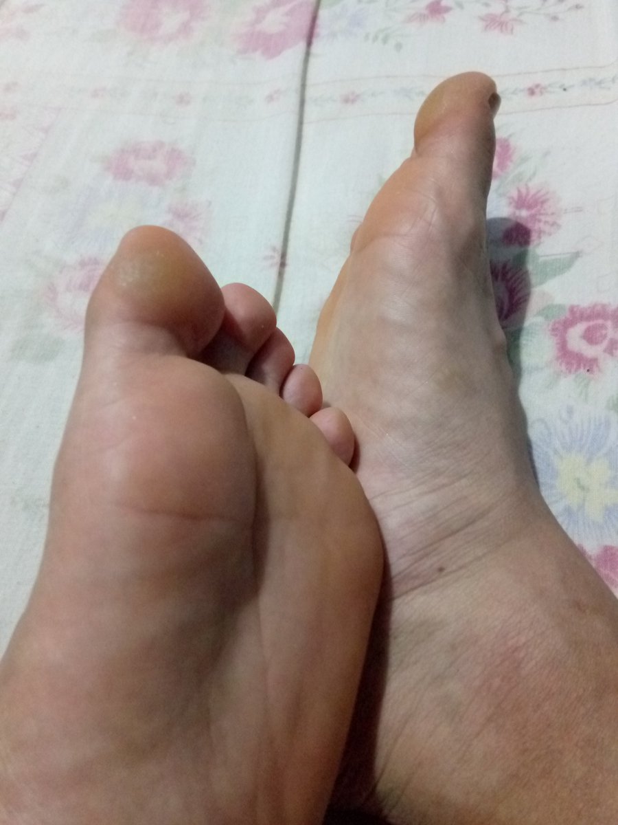 Needing some rubs 😮‍💨