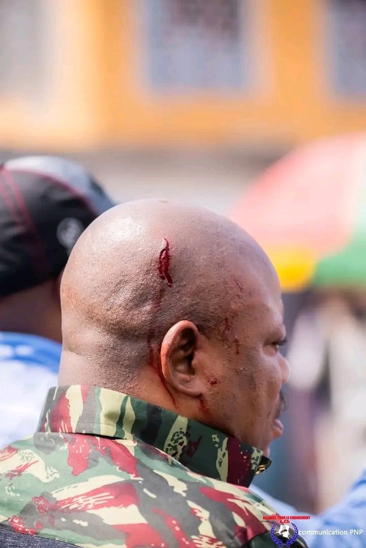 CameraKabund's tweet photo. URGENT 

KABUND BLESSÉ ET PLUSIEURS DE SES MILITANTS PAR LES KULUNAS DE FÉLIX TSHISEKEDI AU CAMP LUKA POUR PERTURBER SA MATINÉE POLITIQUE 💔
@kabund_jmkkrock https://t.co/iixke47SPA