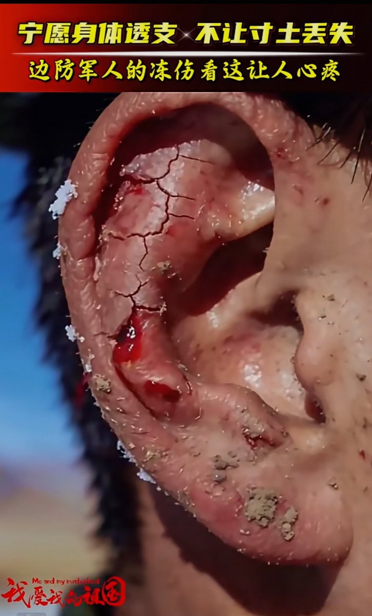 PanZZ(互关必回)💯 tweet media