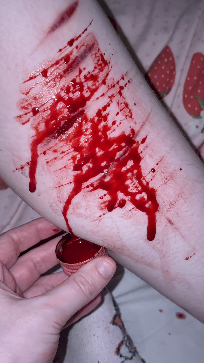 addictkittymeow's tweet photo. lots of shallow cuts bc i wanted to destroy smth :3 #shtwt punishment to myself bc these r gonna feel way more painful than my usual beans but won’t look as cool </3 #goretwt #gore #g0retwt #g0re https://t.co/cxpJyx5oSU
