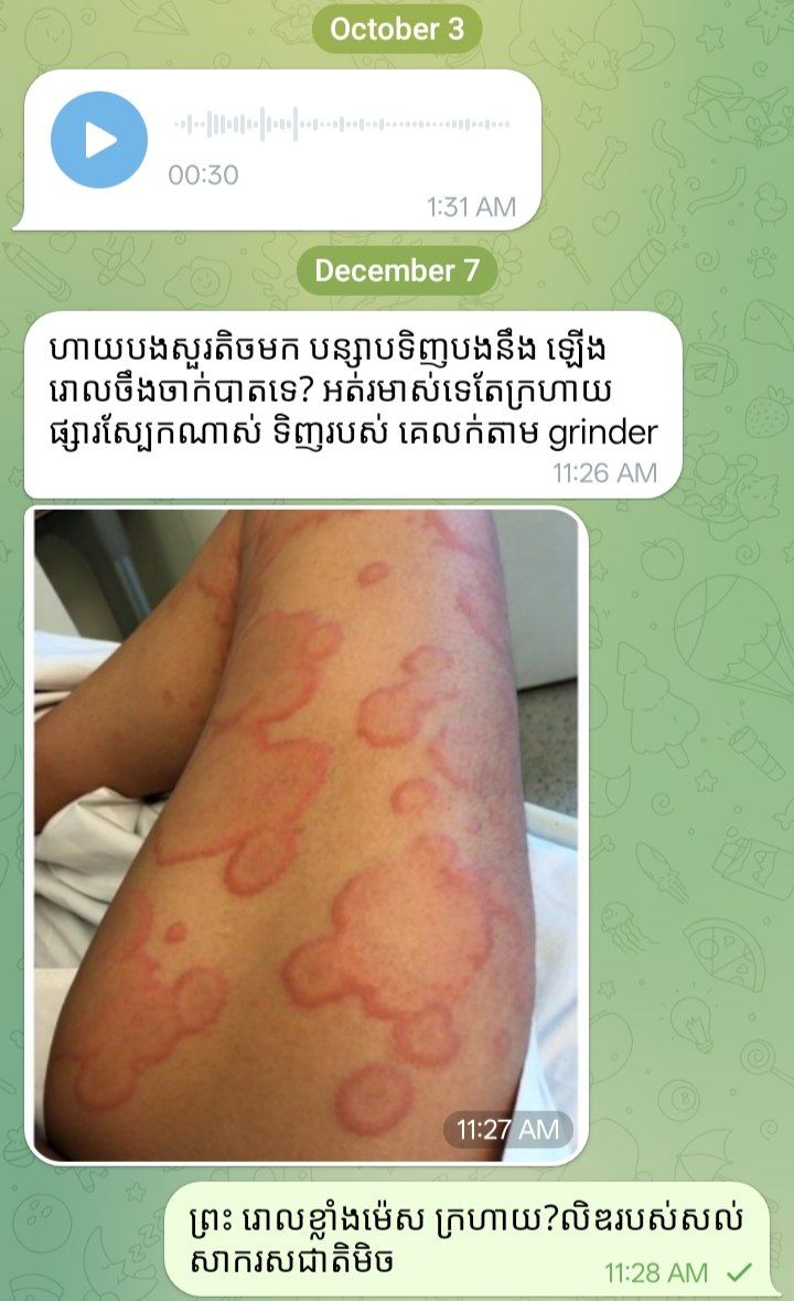 god_sethy17835's tweet image. ឈុតធំហើយបោកនៅស្ទើរ ស្តាយរបស់ស្តាយលុយ ២៥$ ៨ ៩លេខថោកបានច្រើនល់បោកលទ្ធផលបរុសបោកស្ទើរថែមអ្នកលក់ទៀត សុះស្បែកចឹងបានមករកបន្សាបជួយបានតែដឹងបាត់ស្នាមអត់.