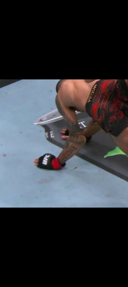 Mizzy_AMM's tweet photo. Crazy injury 
So sad for pantoja. That's a painful way to lose your belt #UFC323 https://t.co/MsTZ36mOwB