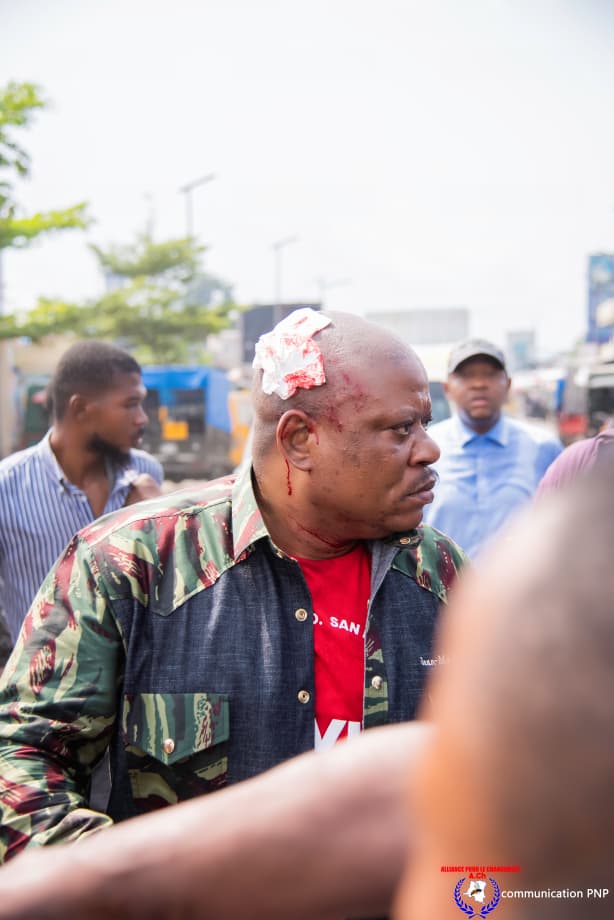 chatNoir_rdc's tweet photo. @kabund_jmkkrock a été tabassé avec ses acolytes à Camp Luka par des kulunas, sous la responsabilité de Samuel Mbemba, actuel ministre des Droits humains.
Un comportement purement inapproprié.
Union sacrée 💔💔💔 https://t.co/TRpZv3PAmk