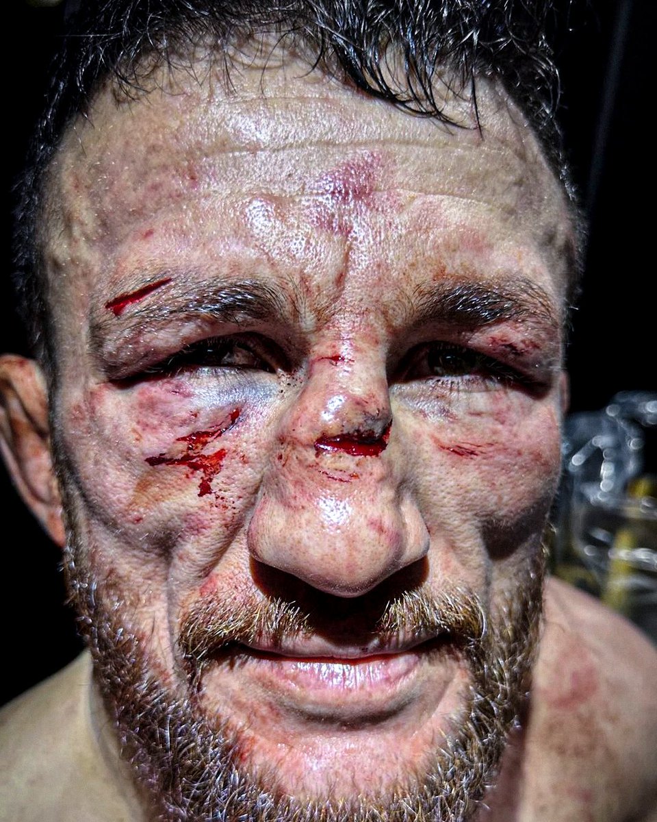 La tête de Merab après 5 rounds contre Petr “No Mercy” Yan. 💀

#UFC323