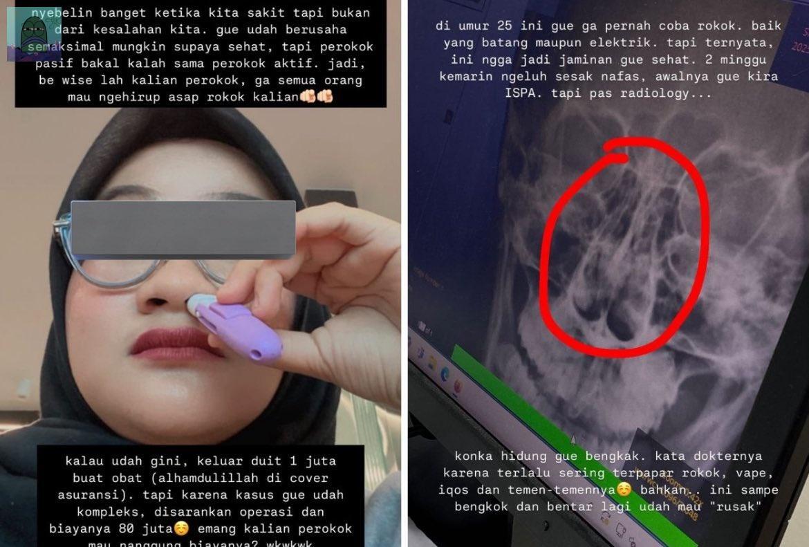 tanyakanrl's tweet image. cw //  rokok penyakit 

💚 Literally diem aja bisa kena penyakit. Emang ajg lo perokok. Kita yang ga ngerokok pun bisa sakit gara-gara lo