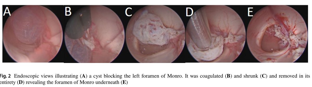 King's Neurosurgery tweet media