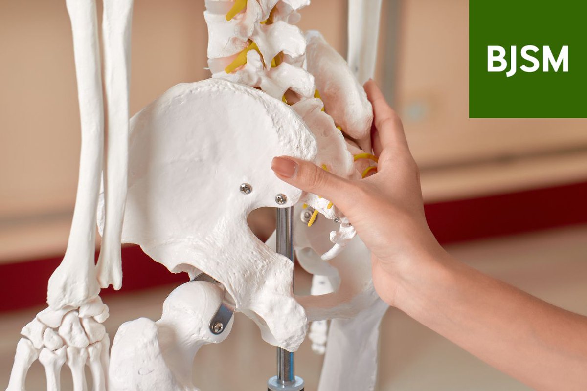 BJSM_BMJ's tweet image. Does CAM morphology in hips lead to osteoarthritis? 🦴⚡️

Results from COACH consortium are in 📄✅

Analysis of 23,886 hips worldwide showed an increased odds ratio of developing OA over 6-8 years.

Read the full paper in the BJSM 👉 bit.ly/4pFdkcr