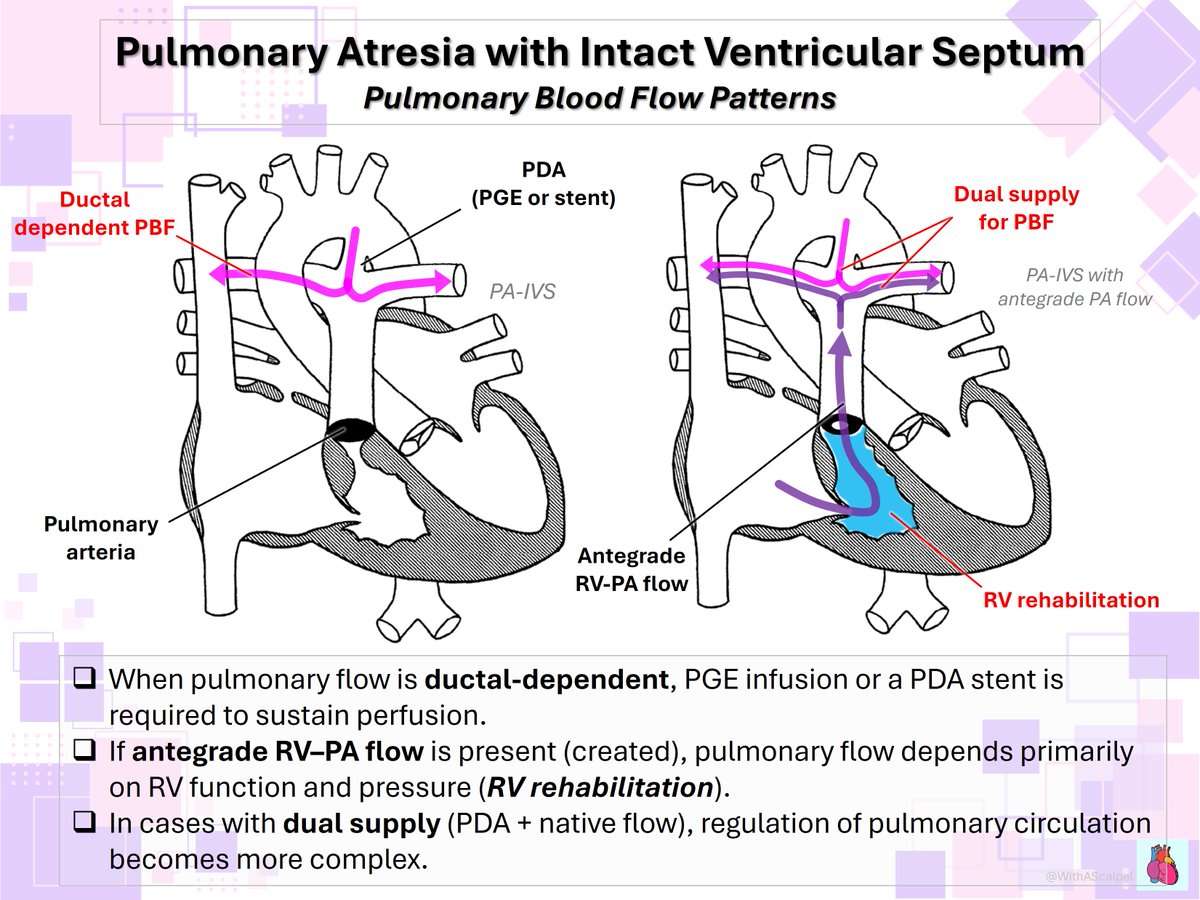 🫀 Cardiology / Critical Care / Cardiac Surgery—clear, diagram-based learning.

"Basics → Clinical → Techniques"

"Step-by-step visuals for beginners—great for quick review."

Follow <a href="/WithAScalpel/">WithAScalpel - Fumiya Yoneyama, MD, PhD</a>
