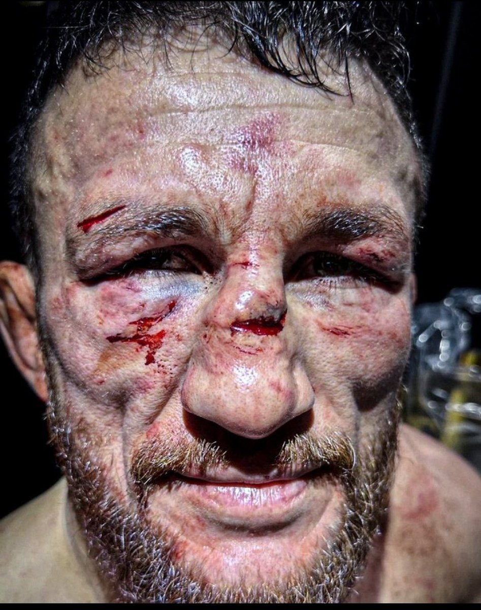 MFX_MMA's tweet photo. BİLMEM KAÇ MAÇTIR YENİLMİYDUOMRJSİXKSJDİKSHFKSJCİSHFİSJXİSKFJJFNSUCKSHXJXĞDOWLDUKEJS https://t.co/dalMlovJDg