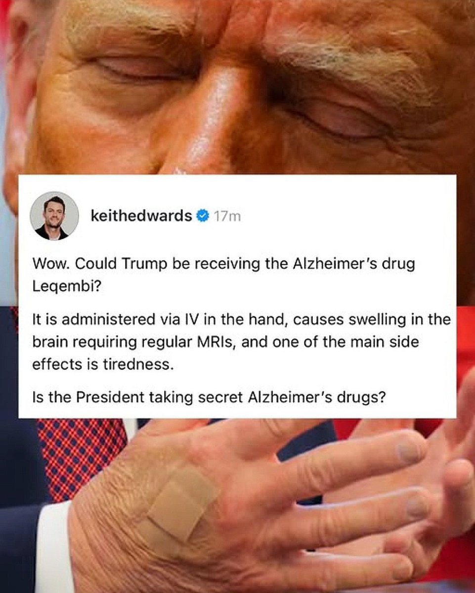 Carina_Amyth's tweet image. Fred Trump died with Alzheimer&apos;s. 🤔