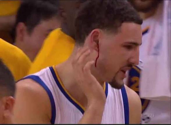 We should be sent financial compensation for this Red Zone audio